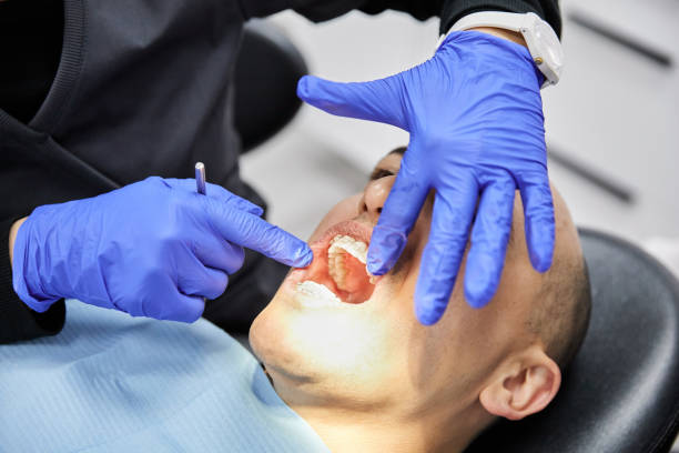 Best Emergency Dentist for Lost Fillings or Crowns in Donald, OR